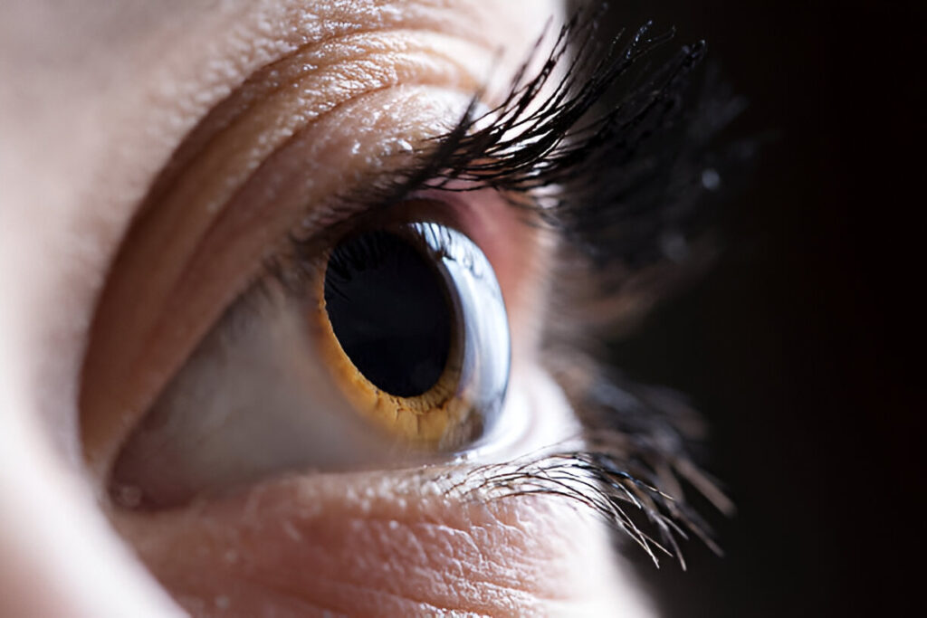 Can Keratoconus Be Cured with Medicine?